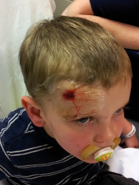 Zach-needing-stitches-20120325_191312